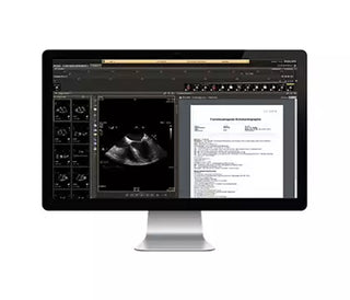 Philips IntelliSpace ECG System - 860332