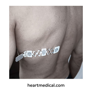EXG™ 3-Lead Wearable ECG (Reversible) — Right-Sided & Posterior Views in One Configuration