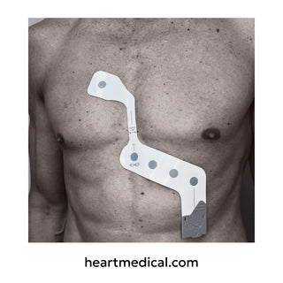 EXG™ 5-Lead Wearable ECG — Continuous Rhythm Monitoring with Optimized P-Wave & QRS Morphology