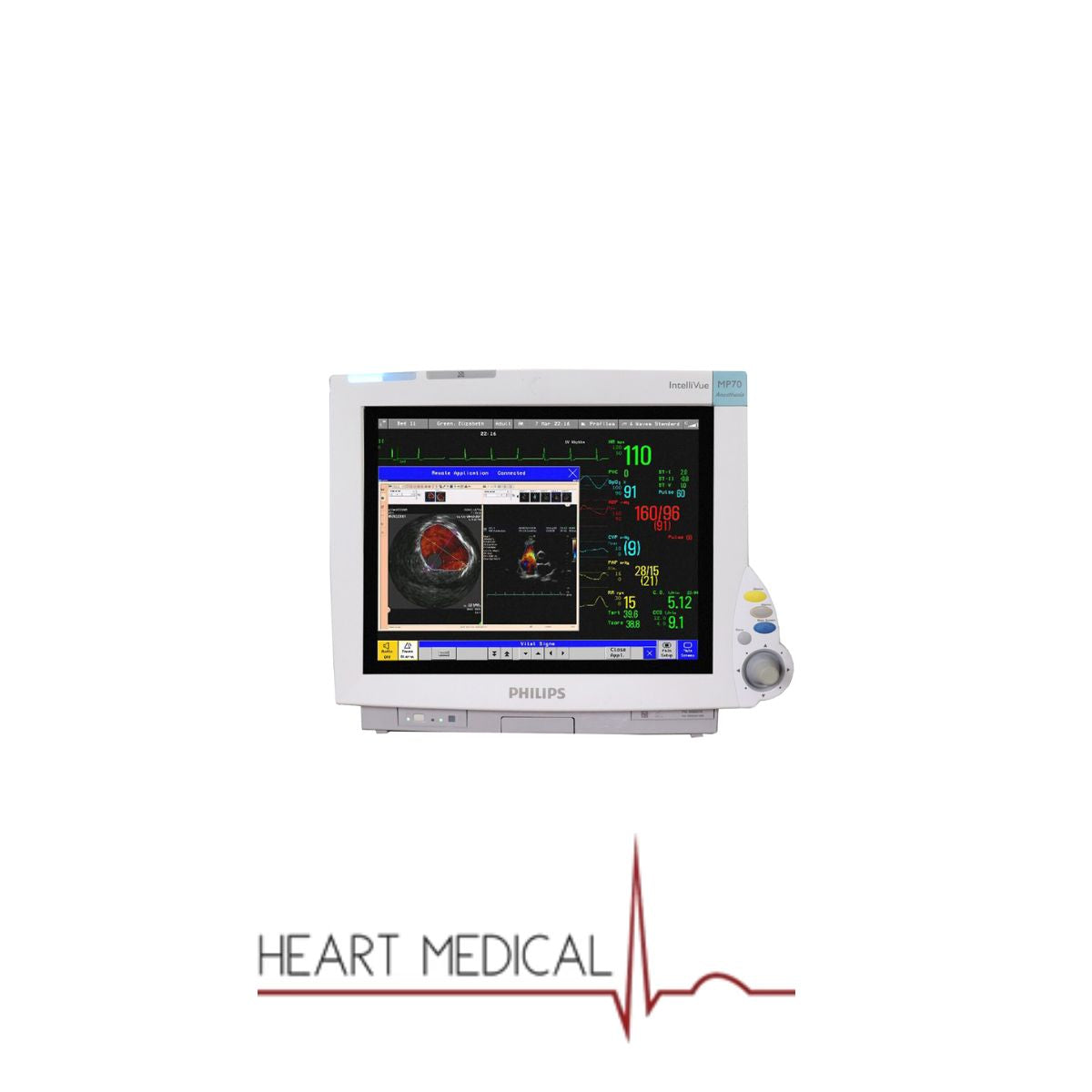 Philips IntelliVue MP70 Patient Monitor – Buy Medical Equipment