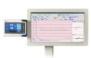 Mortara Q-Stress Cardiac System with Treadmill - Baxter-Q-Stress