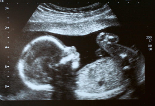 philips ultrasound