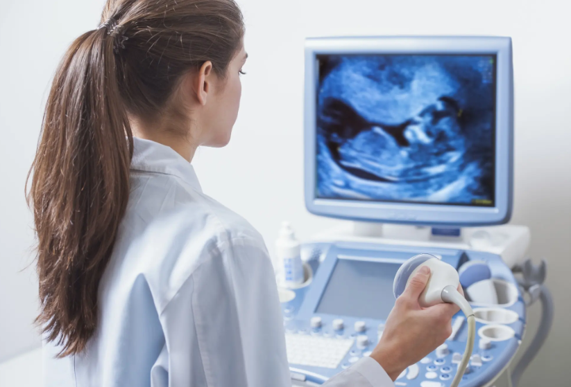 Vivid T9 Ultrasound