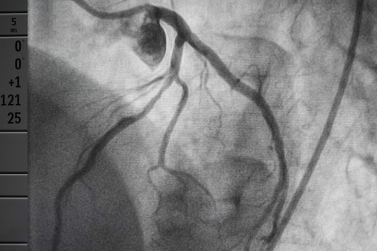 GE MACVU 360 EKG Machine