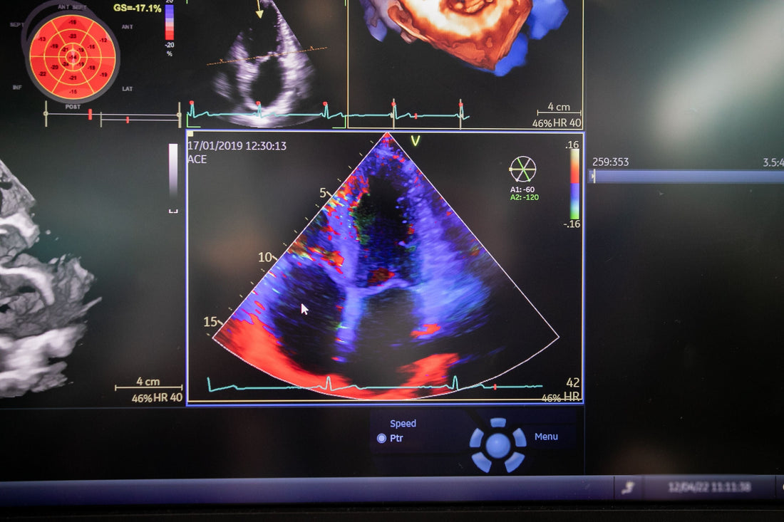 GE LOGIQ E9, 2.0, Xdclear
