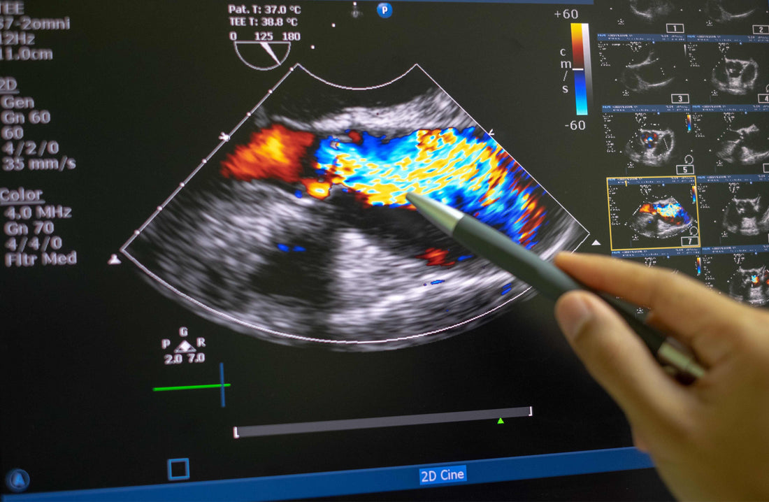 Philips Ultrasound