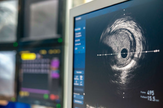 GE Vivid T9 ultrasound macine