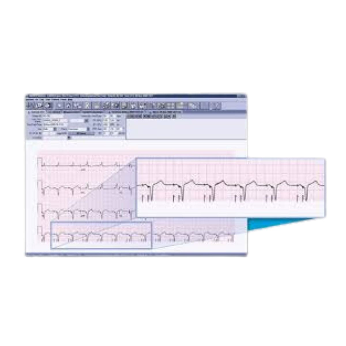 GE Muse NX Software Package | Heart Medical