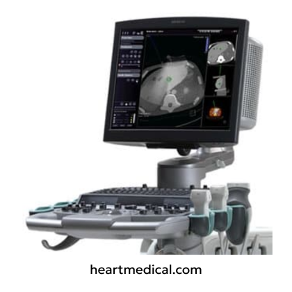 Siemens Healthineers ACUSON S3000 ultrasound system with HD monitor, control panel, and probes on cart in clinic