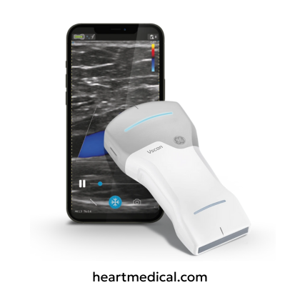 GE Healthcare Vscan Air handheld wireless ultrasound probe with smartphone display in clinical use