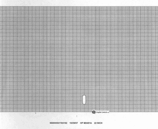 Philips M2481A EKG Paper | Generic