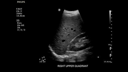 Philips Sparq Ultrasound Machine | Heart Medical