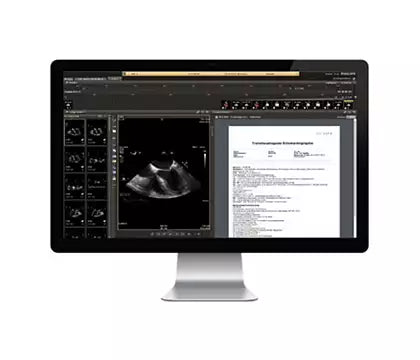 Philips IntelliSpace ECG System