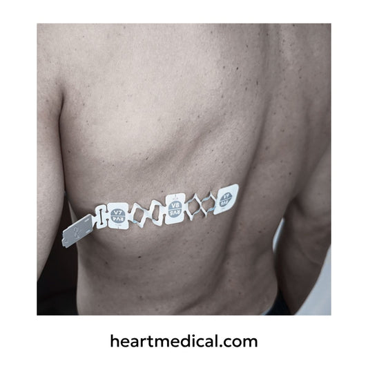 Back view of EXG 3-Lead Wearable ECG applied in posterior orientation
