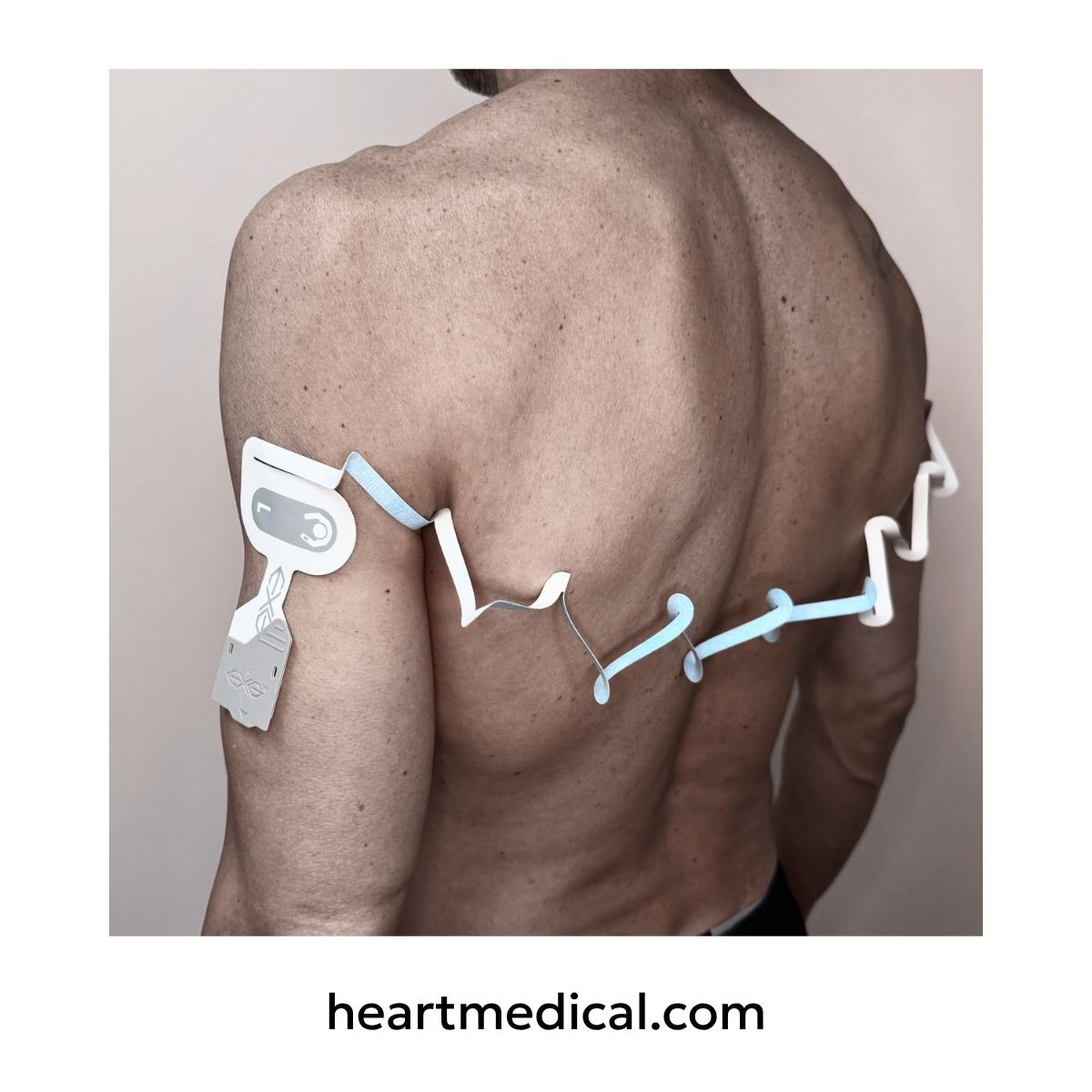 EXG 4-Electrode Wearable ECG in EMS shoulder placement for prehospital use