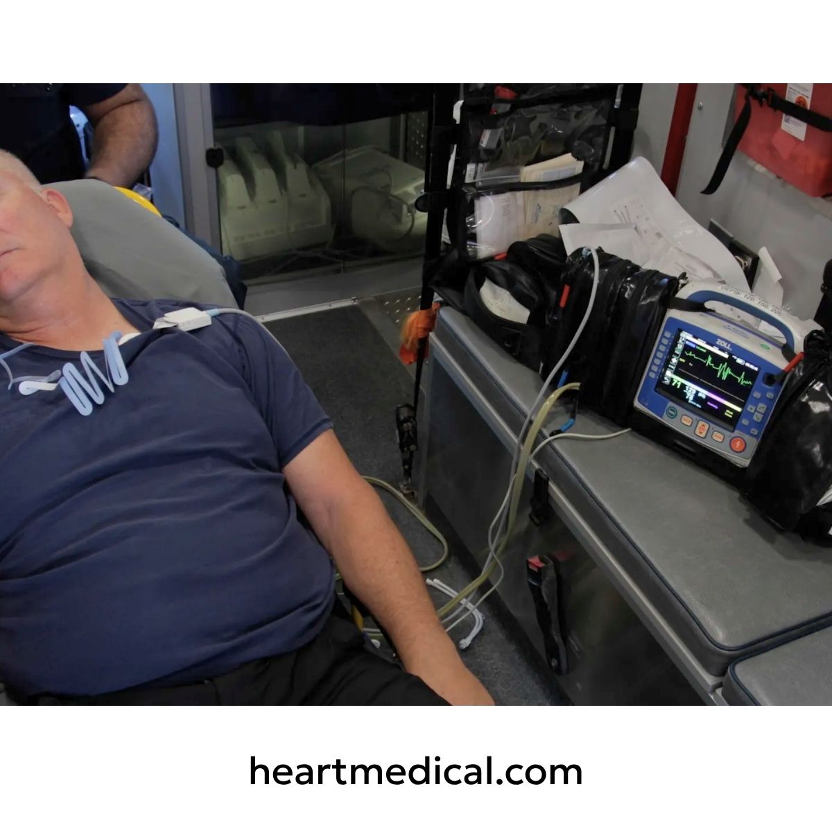 EXG Wearable ECG in EMS ambulance deployment with ZOLL cardiac monitor