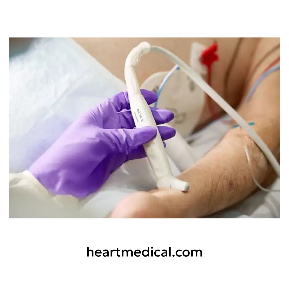 Clinician holding Philips mL26-8 transducer on a patient's arm for vascular ultrasound.